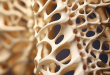 Остеопороз: как сохранить здоровье костей